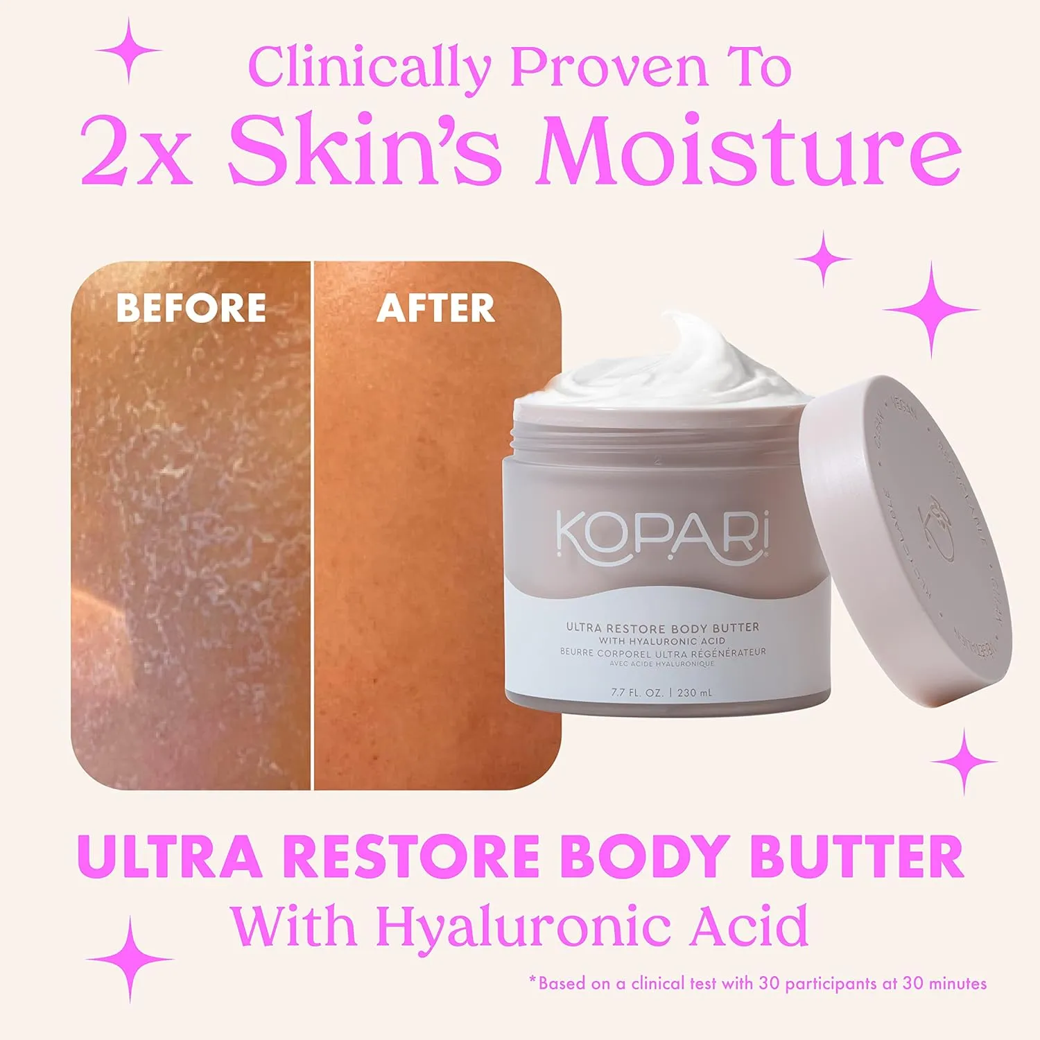 Kopari Ultra Restore Body Butter, Whipped Lightweight Formula, Hyaluronic Acid & Mango Butter, Deep Long-Lasting Moisture, Tahitian Vanilla 7.7 oz